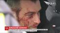 Семеро задержанных и избитый нардеп: жители столичной Татарки протестуют против застройки