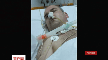 Боєць батальйону «Чернігів» впав у кому під час реабілітації у Грецькій лікарні