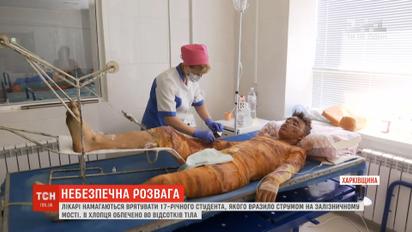 Харківські лікарі рятують життя 17-річного студента, який дістав потужний удар струмом
