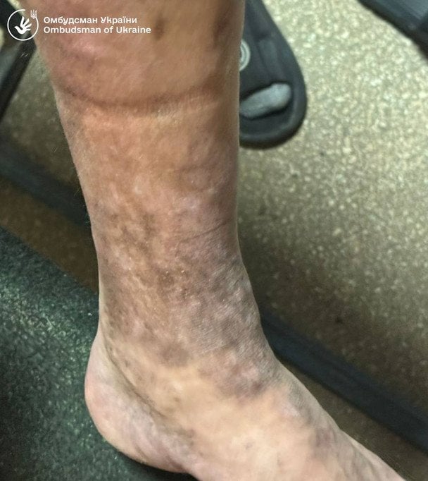  / © Дмитро Лубінець facebook