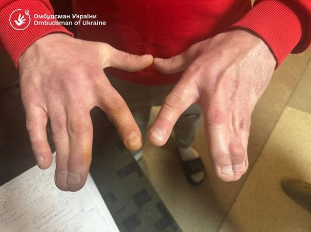  / © Дмитро Лубінець facebook