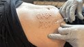 Шрам с надписью "Слава России" сделали российские врачи