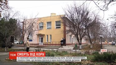 В Одесі однорічна дитина померла від ускладнень від кору