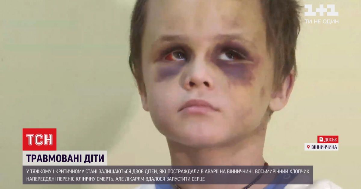 Внаслідок дтп у вінницькій області двоє дітей тяжко травмувалися і залишися без опікунів