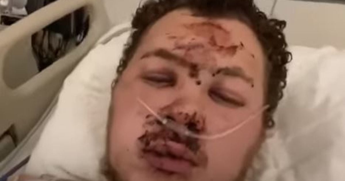 У США далекобійника з України причавило плитами у 10 тонн: на лікування потрібно $300 тис.