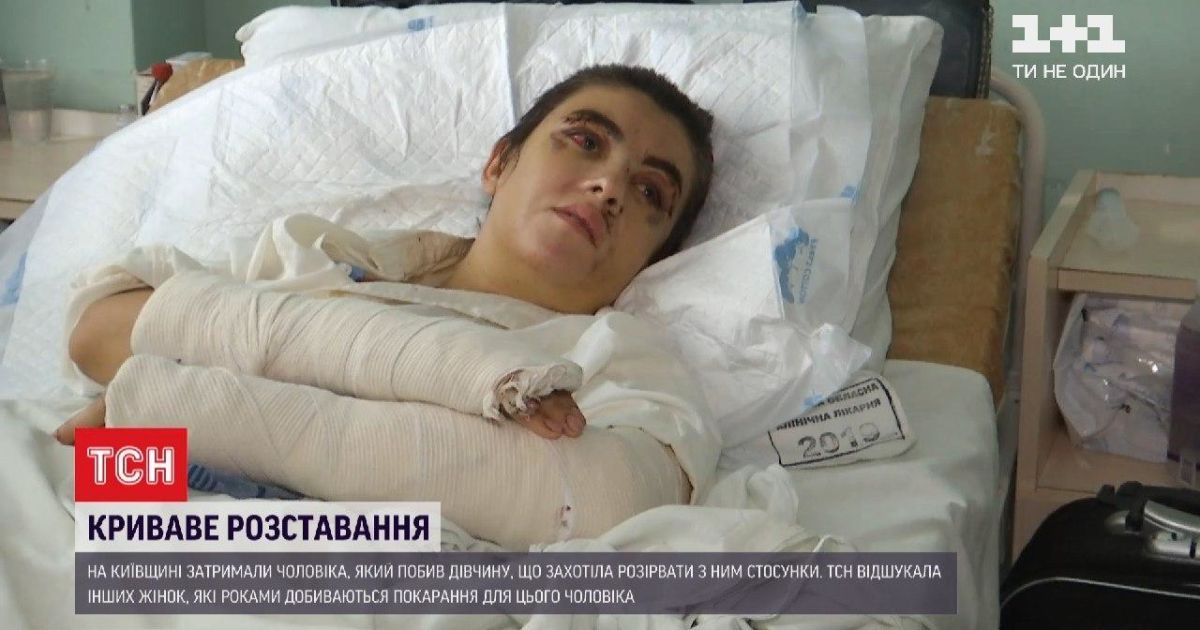 "Почувствовала удар по голове и начала звать на помощь": ТСН нашла жертв нападений серийного преступника под Киевом