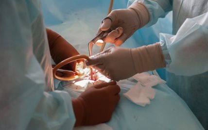 Українські хірурги провели надскладну операцію, яку не наважуються робити в світі