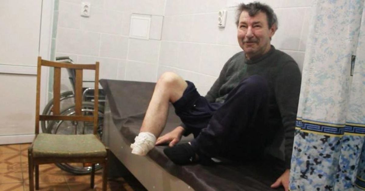 На Сумщине госпитализировали мужчину, который кухонным ножом ампутировал себе ступню и выбросил на улицу