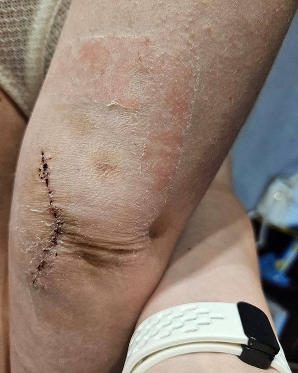 Адвокатка, яку побили у Київському районному ТЦК та СП в Харкові / © Дмитро Лубінець