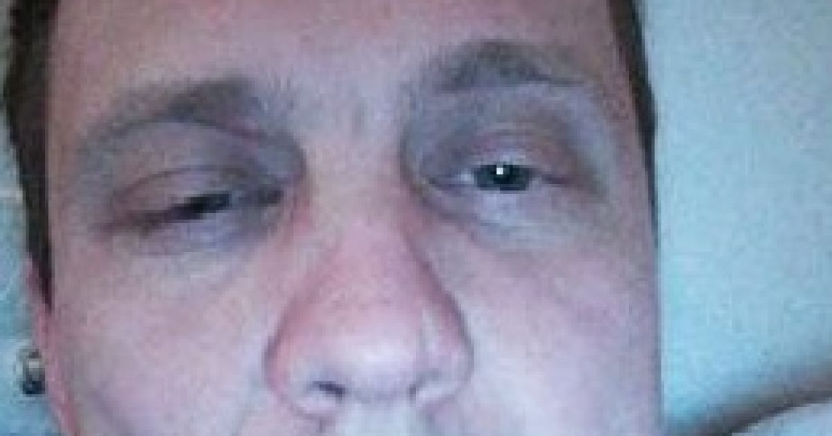 На Киевщине избиение депутата от "УКРОПа" спровоцировало ожесточенную дискуссию в мэрии