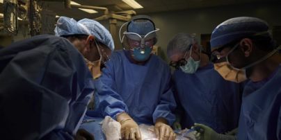 Американские хирурги впервые пересадили человеку почку от ГМО-свиньи