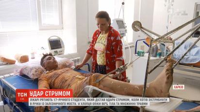 Лікарі в Харкові рятують життя студента, який дістав потужний удар струмом