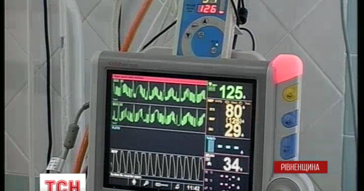 В Украине дискутируют, нужно ли открывать для родителей детские реанимации