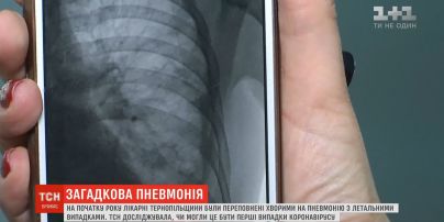 В январе на Тернопольщине было много больных пневмонией: был ли это коронавирус