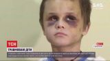 В результате ДТП в Винницкой области двое детей тяжело травмировались и остались без опекунов