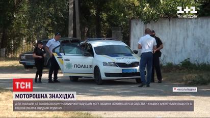 Моторошна знахідка: на спортмайданчику діти знайшли відрізану ногу