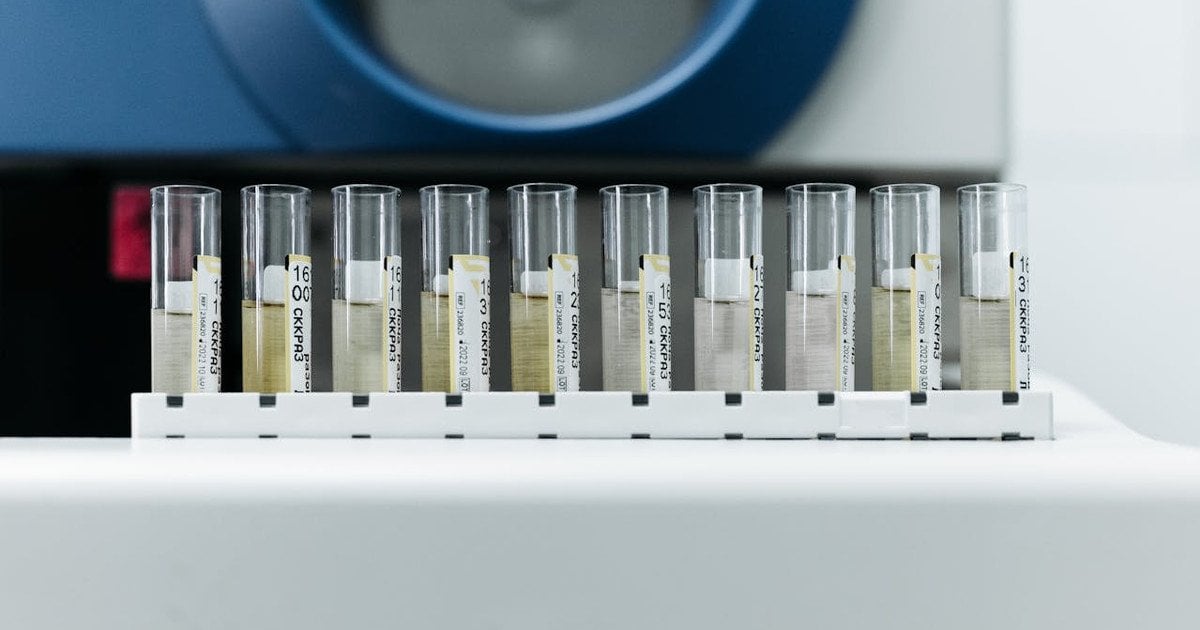 мРНК-вакцина проти раку підшлункової залози показала проривний ефект