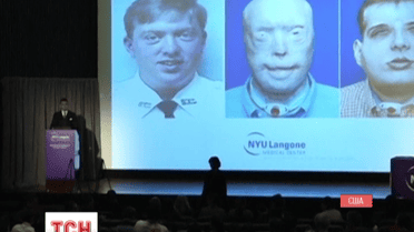 Нове обличчя отримав пожежник із Нью-Йорка Патрік Хардісон