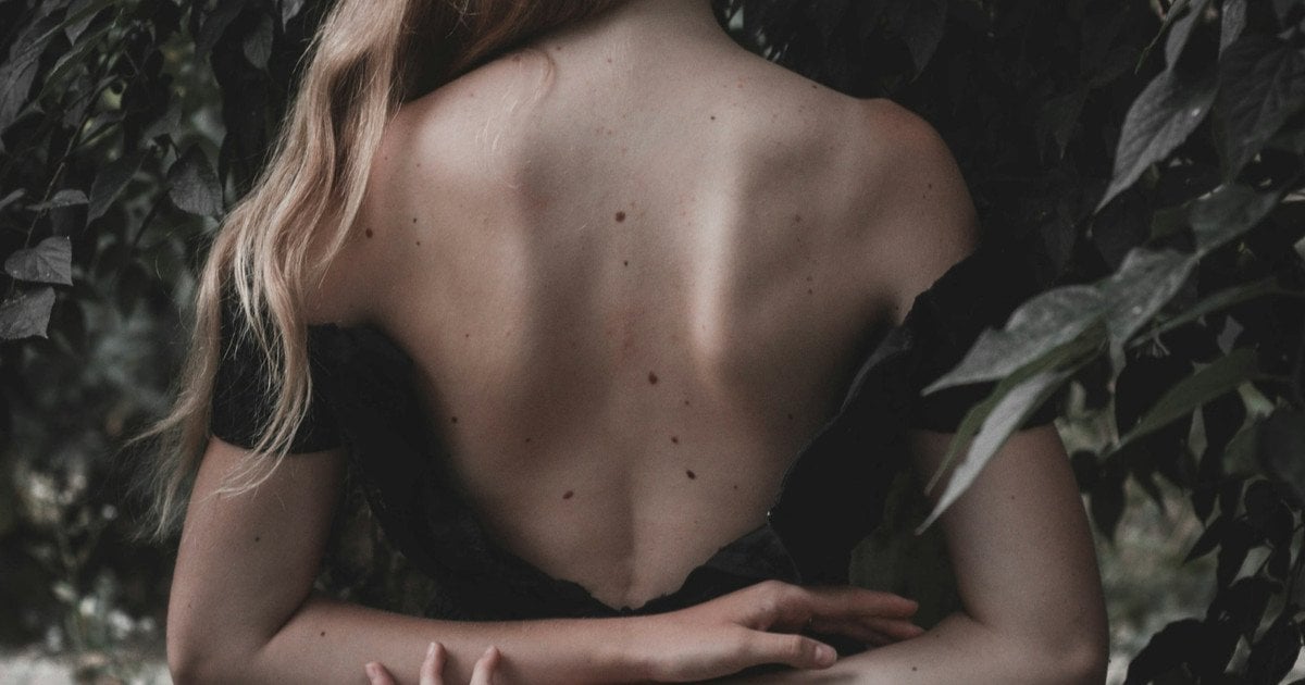 Які родимки приносять удачу і багатство