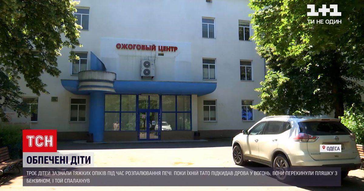 Новости Украины: в Одесской области трое детей получили тяжелые ожоги во время растопки печи