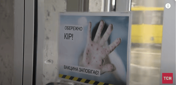 В Україні спалах кору / © ТСН