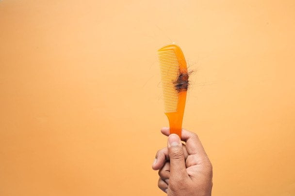 1 серпня Міжнародний день алопеції / © pexels.com