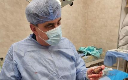 "Дістали нерозірвану частину гранати з-під серця": подробиці унікальної операції українських хірургів