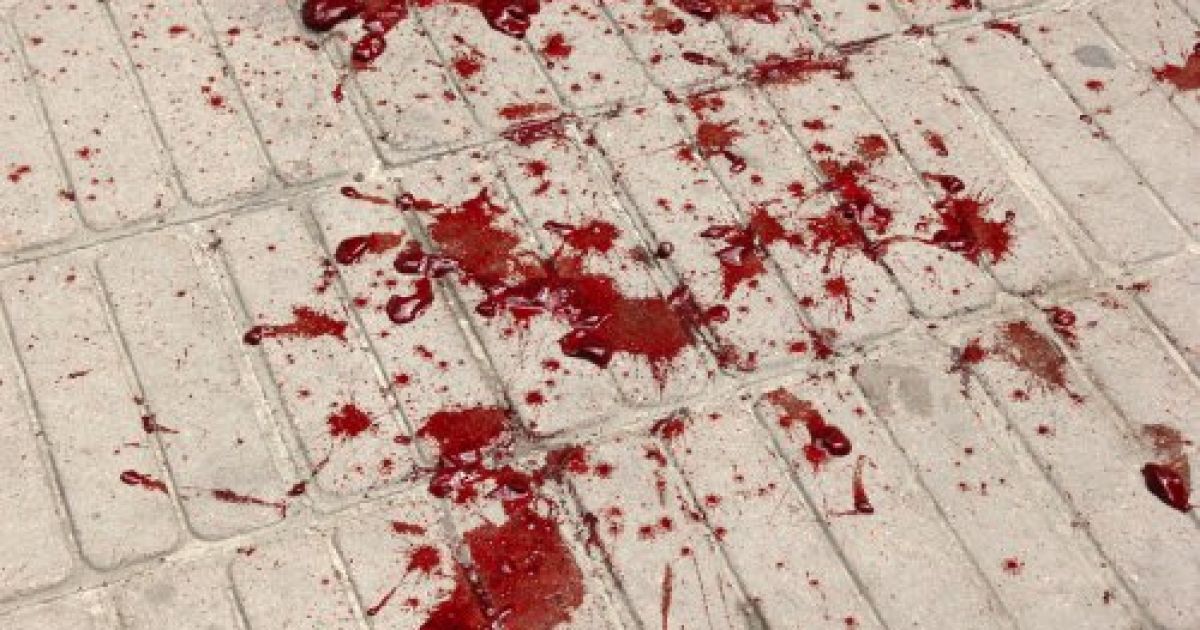 В драке пострадали несколько человек