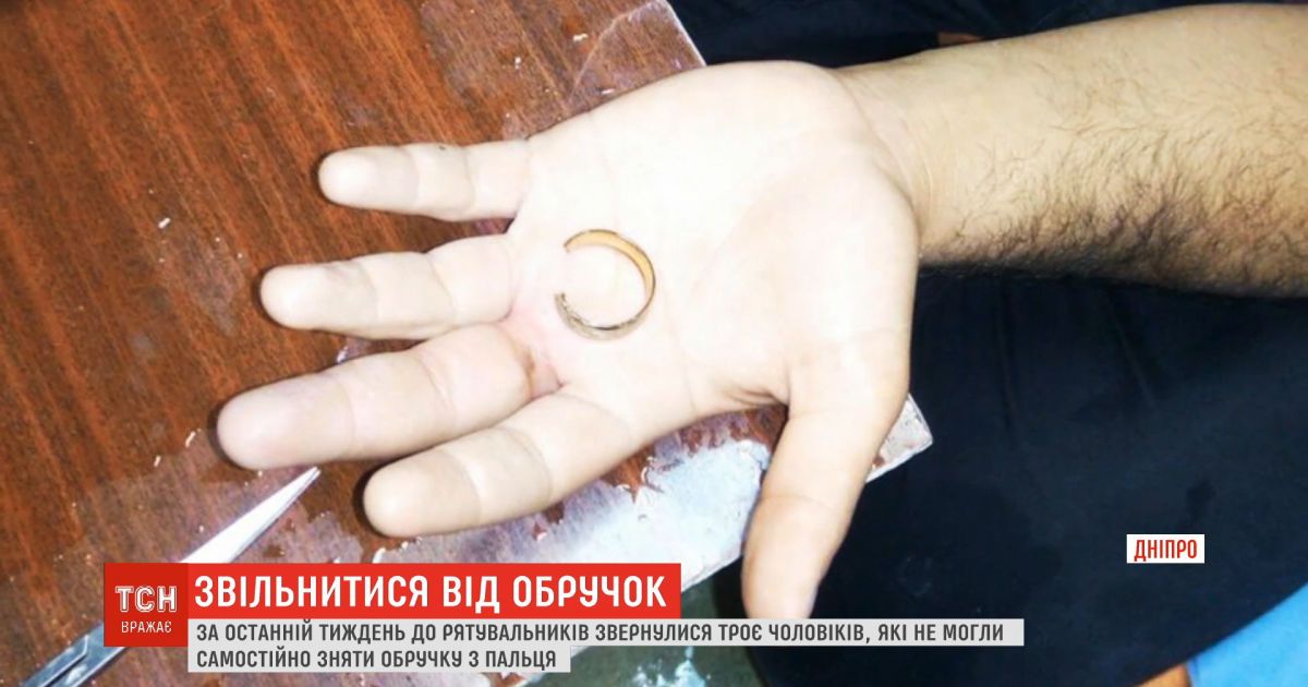 В Днепре спасатели массово освобождают мужчин от обручальных колец