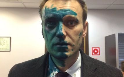 В России оппозиционера Навального облили зеленкой