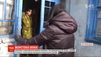 У Житомирській області дитину з інвалідністю побила опікунка, яка доводиться їй тіткою