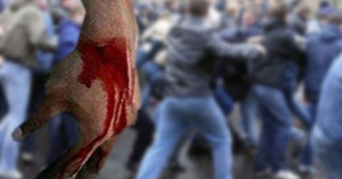 У масовій бійці загинув 20-річний хлопець.