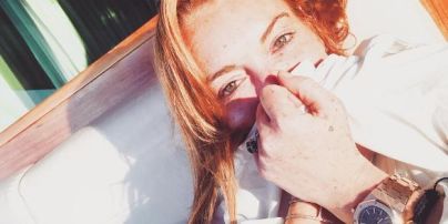 Линдси Лохан оторвало фалангу пальца во время катания на яхте