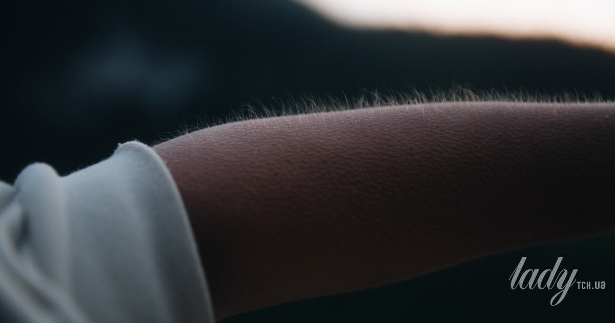 пилоэрекция