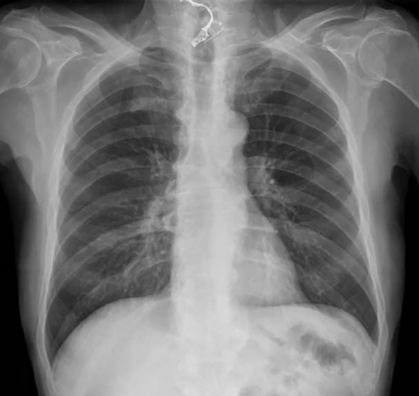 Чоловік проковтнув зубні протези / Фото: Jam Press Чоловік проковтнув зубні протези / Фото: Jam Press