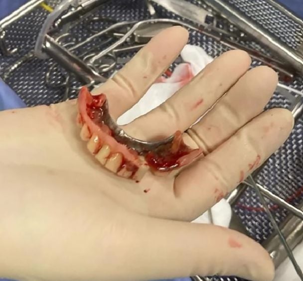 Чоловік проковтнув зубні протези / Фото: Jam Press Чоловік проковтнув зубні протези / Фото: Jam Press