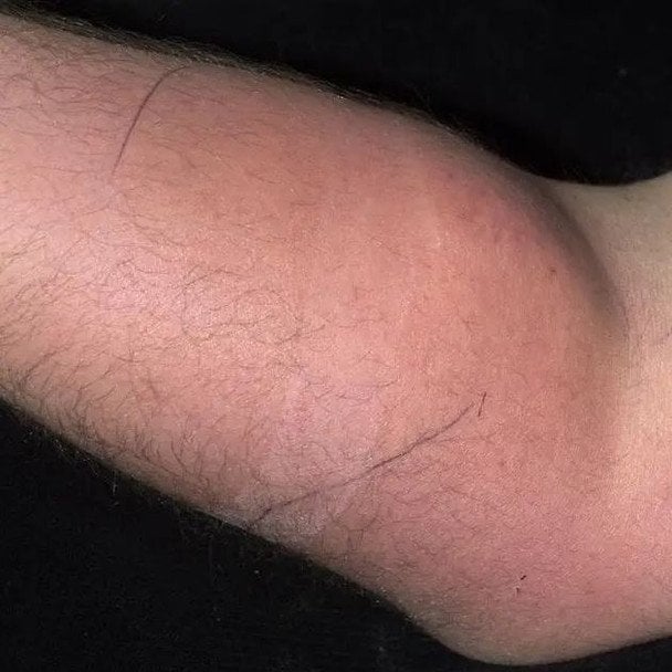 Рука пациента / Фото: Irish Medical Journal