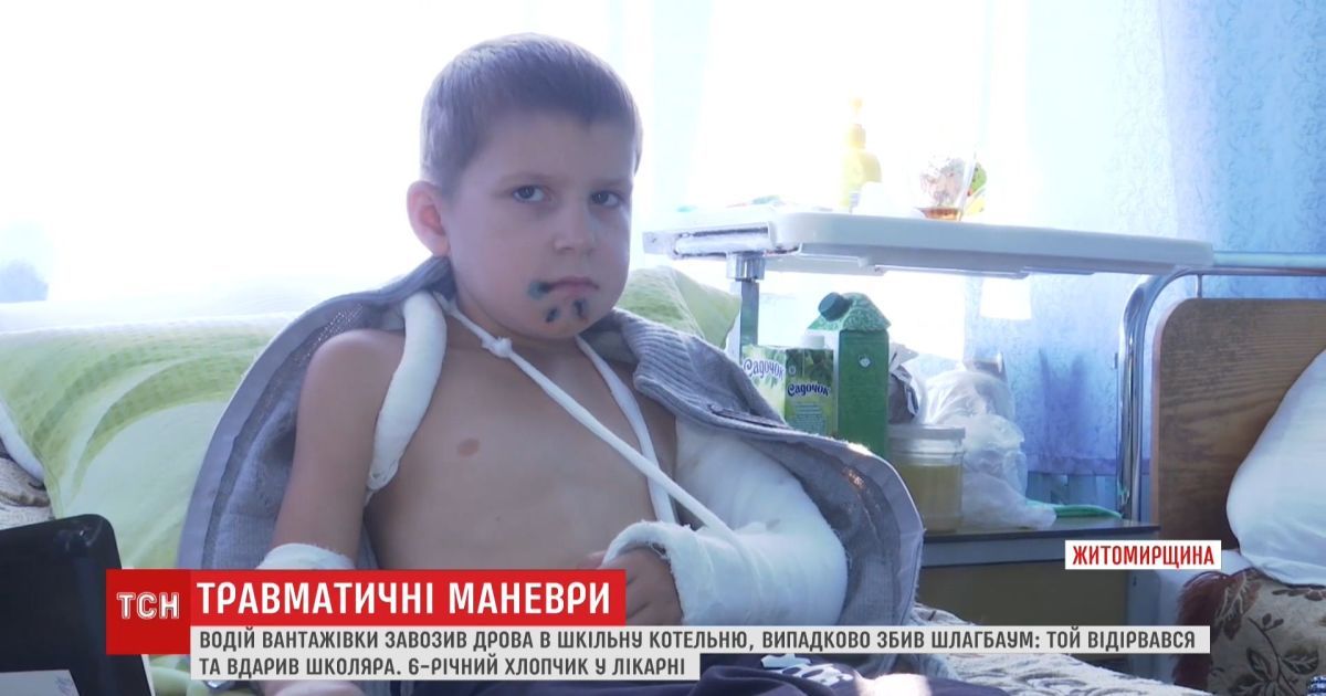 На житомирщине после удара шлагбаумом ребенок в тяжелом состоянии попала в больницу