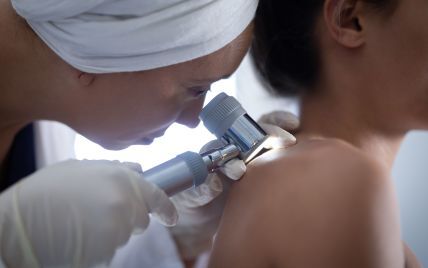 Дерматоскопия – диагностика раннего выявления рака кожи: кому нужна, насколько эффективна