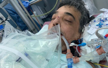 Мужчина с коронавирусом провел семь месяцев в больнице