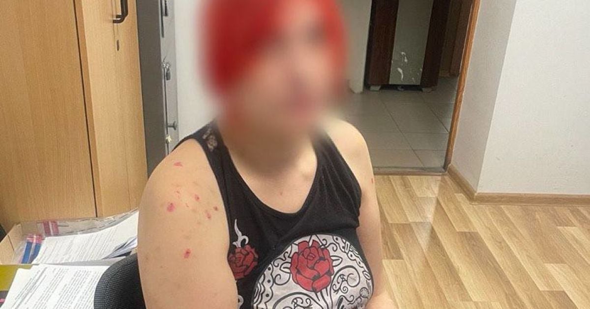 У Києві жінка вдарила ножем співмешканку колишнього чоловіка