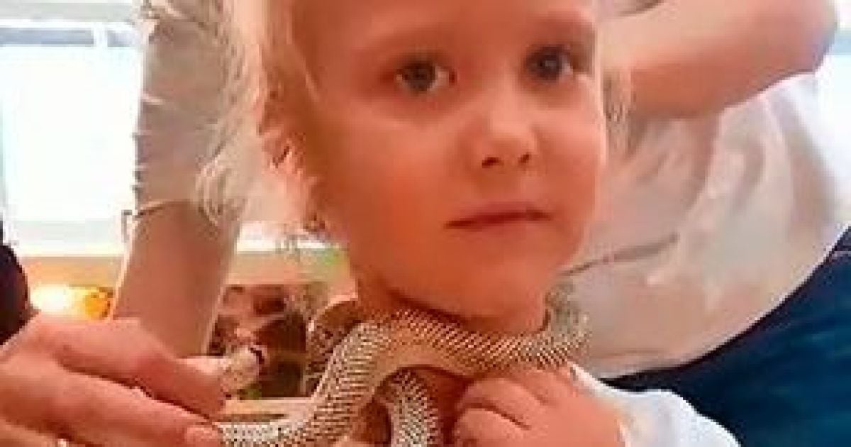 Ужасный инцидент: 5-летнюю девочку за лицо укусила ядовитая змея в зоопарке (фото)