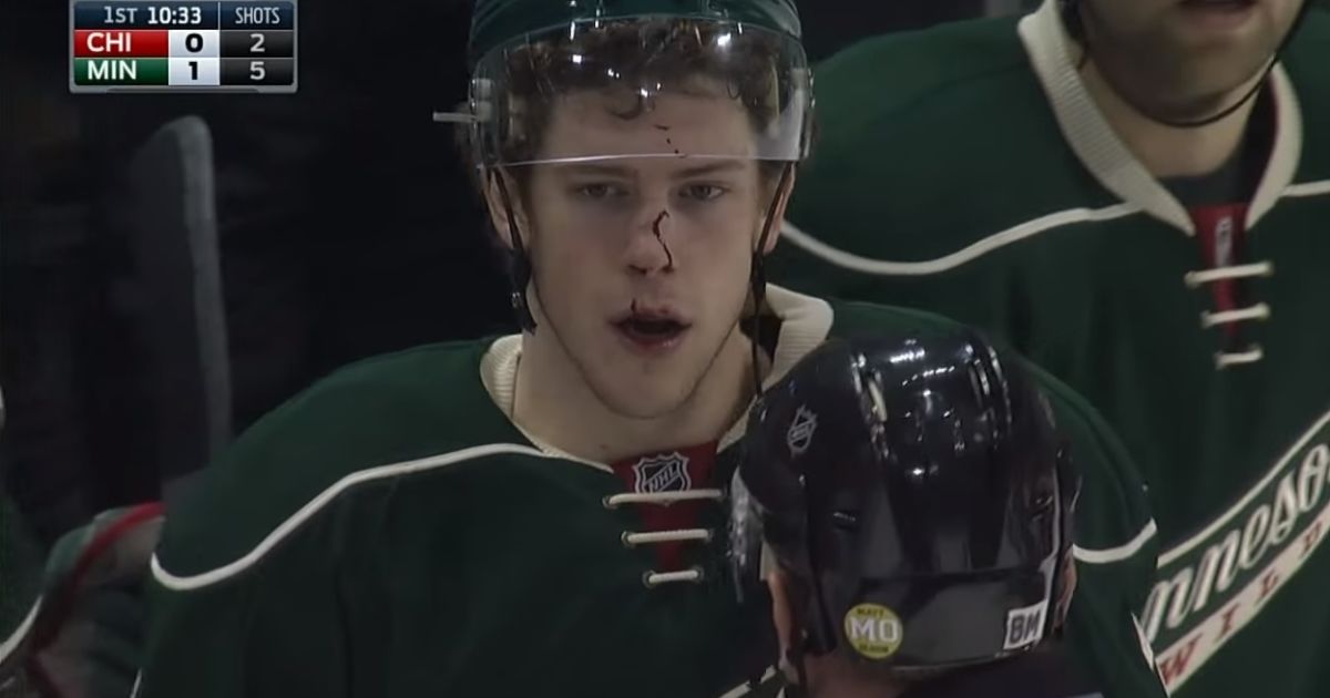 Койл получил клюшкой в лицо.