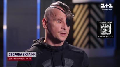 Мечтает увидеть победу собственными глазами! История бойца, который потерял зрение на войне