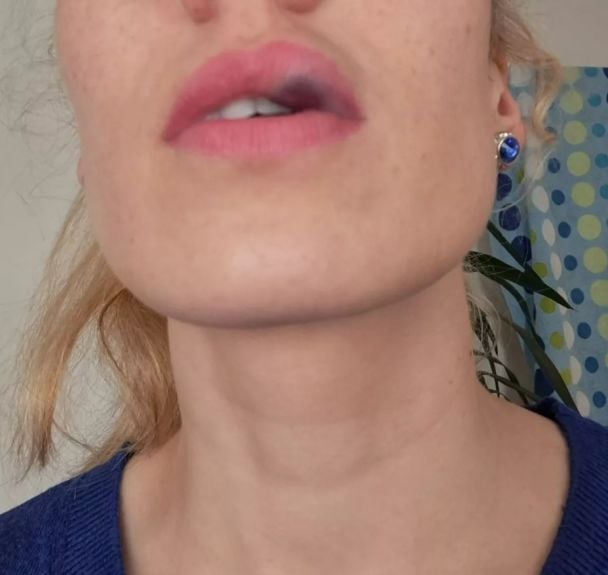 Эдита Джукайте