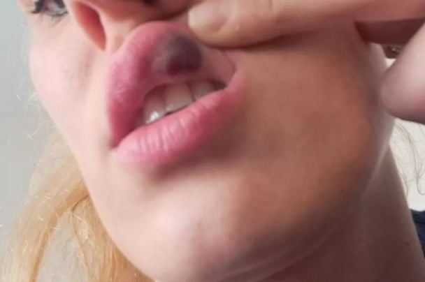 Эдита Джукайте