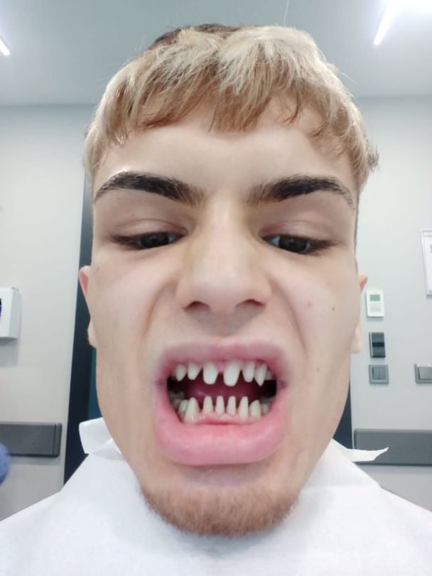 Він полетів на процедуру до Туреччини / © dailystar.co.uk