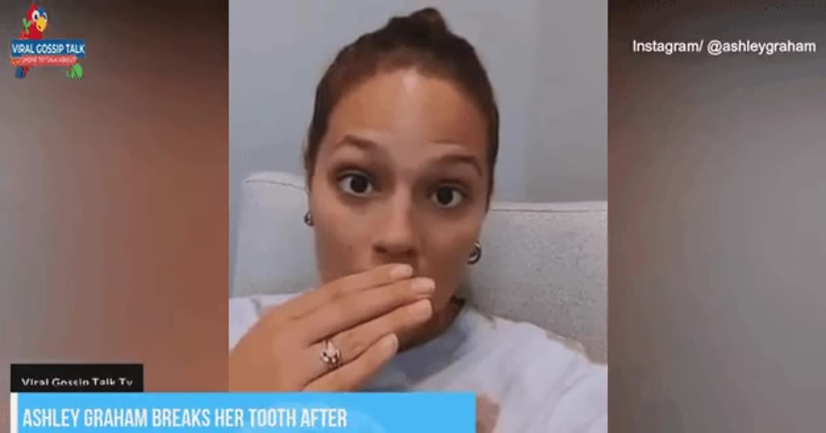 Эшли Грэм со сломанным передним зубом напугала фанатов