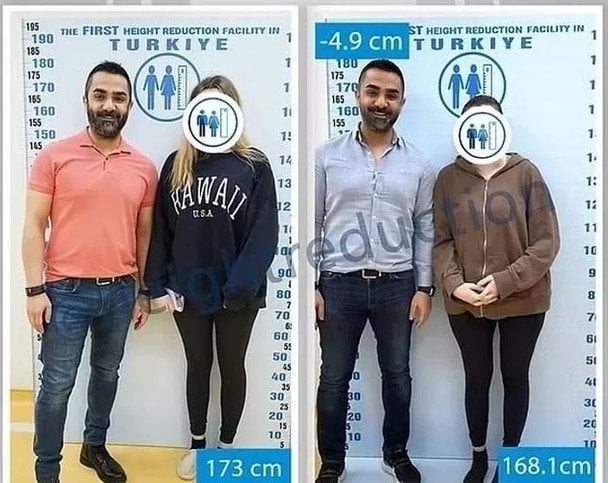 Жінка до і після операції
