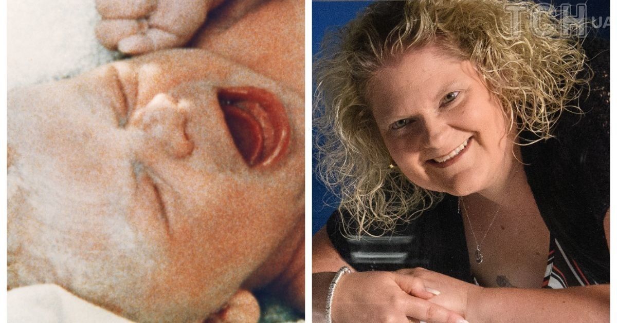 Луїза Браун